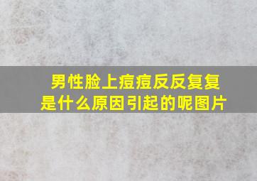 男性脸上痘痘反反复复是什么原因引起的呢图片