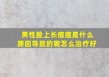 男性脸上长痘痘是什么原因导致的呢怎么治疗好