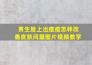 男生脸上出痘痘怎样改善皮肤问题图片视频教学