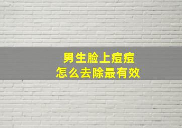 男生脸上痘痘怎么去除最有效