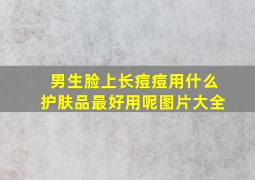 男生脸上长痘痘用什么护肤品最好用呢图片大全