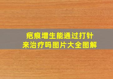 疤痕增生能通过打针来治疗吗图片大全图解