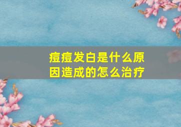 痘痘发白是什么原因造成的怎么治疗