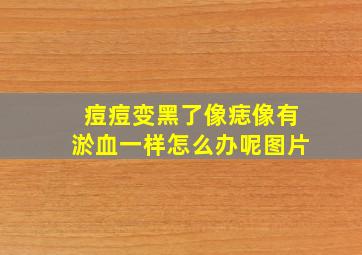 痘痘变黑了像痣像有淤血一样怎么办呢图片