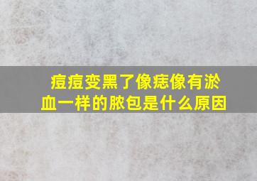 痘痘变黑了像痣像有淤血一样的脓包是什么原因