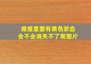 痘痘里面有黑色淤血会不会消失不了呢图片