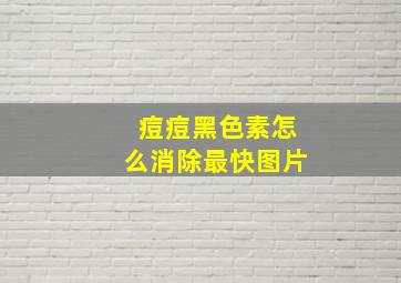 痘痘黑色素怎么消除最快图片