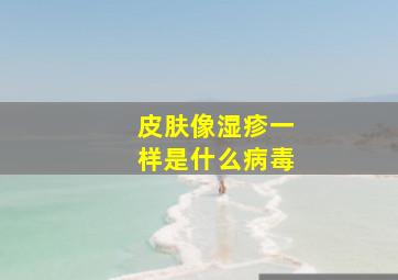 皮肤像湿疹一样是什么病毒