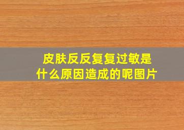 皮肤反反复复过敏是什么原因造成的呢图片