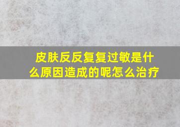 皮肤反反复复过敏是什么原因造成的呢怎么治疗