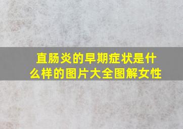 直肠炎的早期症状是什么样的图片大全图解女性