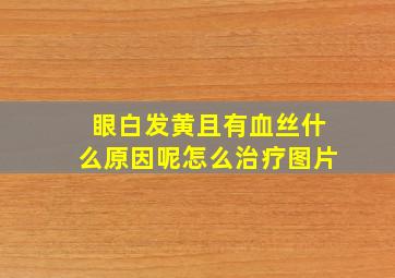 眼白发黄且有血丝什么原因呢怎么治疗图片