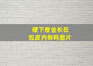 硬下疳会长在包皮内侧吗图片