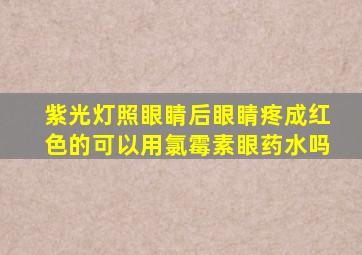 紫光灯照眼睛后眼睛疼成红色的可以用氯霉素眼药水吗