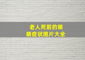 老人死前的眼睛症状图片大全