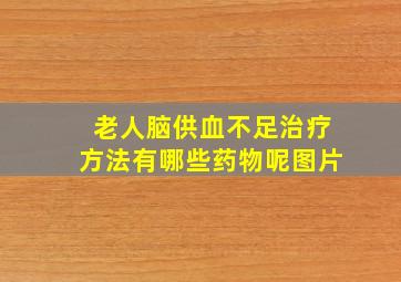 老人脑供血不足治疗方法有哪些药物呢图片