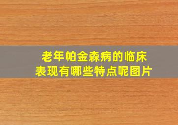 老年帕金森病的临床表现有哪些特点呢图片