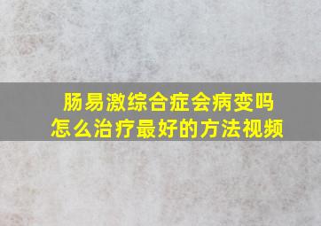 肠易激综合症会病变吗怎么治疗最好的方法视频