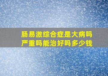 肠易激综合症是大病吗严重吗能治好吗多少钱