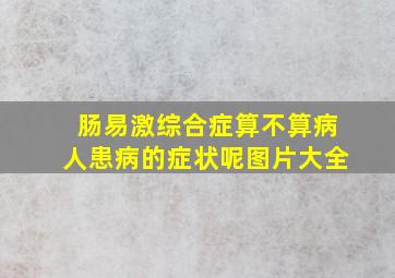 肠易激综合症算不算病人患病的症状呢图片大全