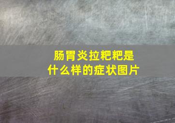 肠胃炎拉粑粑是什么样的症状图片