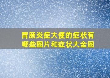 胃肠炎症大便的症状有哪些图片和症状大全图