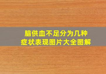 脑供血不足分为几种症状表现图片大全图解