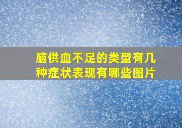 脑供血不足的类型有几种症状表现有哪些图片