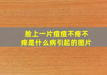 脸上一片痘痘不疼不痒是什么病引起的图片