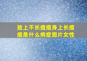 脸上不长痘痘身上长痘痘是什么病症图片女性