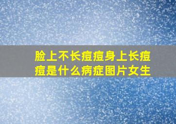 脸上不长痘痘身上长痘痘是什么病症图片女生