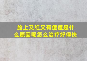 脸上又红又有痘痘是什么原因呢怎么治疗好得快