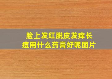 脸上发红脱皮发痒长痘用什么药膏好呢图片