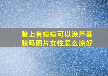 脸上有痘痘可以涂芦荟胶吗图片女性怎么涂好