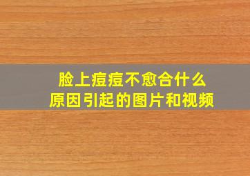 脸上痘痘不愈合什么原因引起的图片和视频