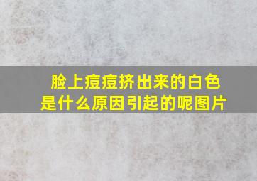 脸上痘痘挤出来的白色是什么原因引起的呢图片