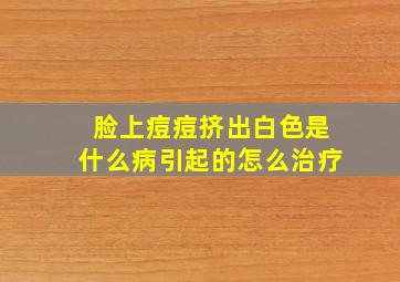 脸上痘痘挤出白色是什么病引起的怎么治疗