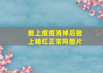 脸上痘痘消掉后脸上暗红正常吗图片