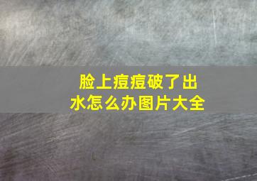 脸上痘痘破了出水怎么办图片大全