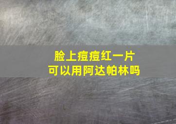 脸上痘痘红一片可以用阿达帕林吗