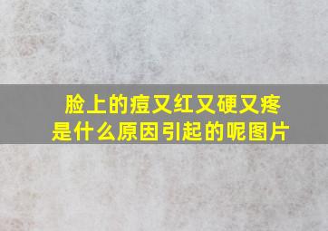 脸上的痘又红又硬又疼是什么原因引起的呢图片