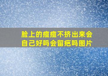 脸上的痘痘不挤出来会自己好吗会留疤吗图片