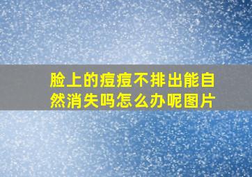 脸上的痘痘不排出能自然消失吗怎么办呢图片