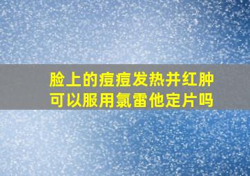 脸上的痘痘发热并红肿可以服用氯雷他定片吗