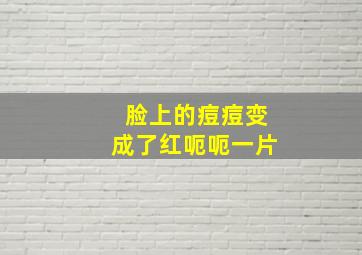 脸上的痘痘变成了红呃呃一片