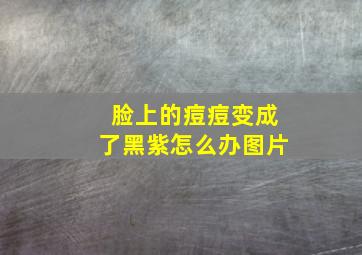 脸上的痘痘变成了黑紫怎么办图片