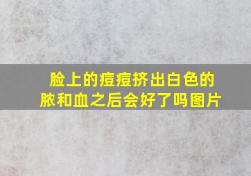 脸上的痘痘挤出白色的脓和血之后会好了吗图片