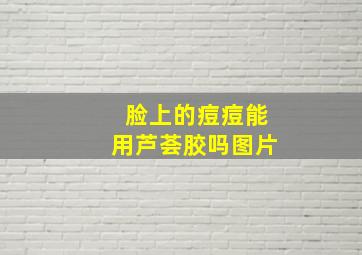 脸上的痘痘能用芦荟胶吗图片