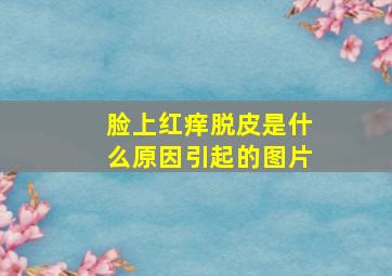 脸上红痒脱皮是什么原因引起的图片