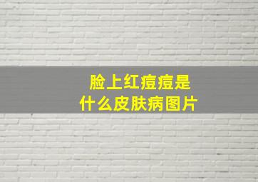 脸上红痘痘是什么皮肤病图片